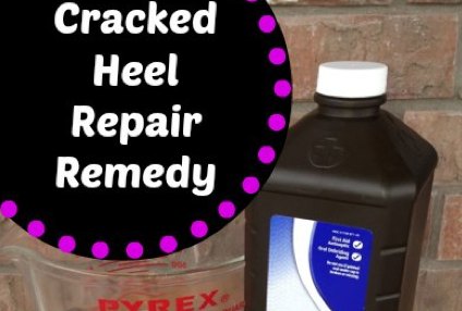 Cracked Heel Remedy –  For Super Soft Feet!