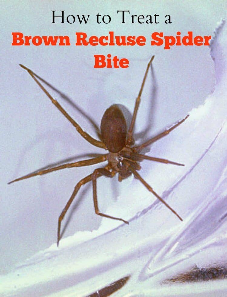 How to Treat a Brown Recluse Spider Bite