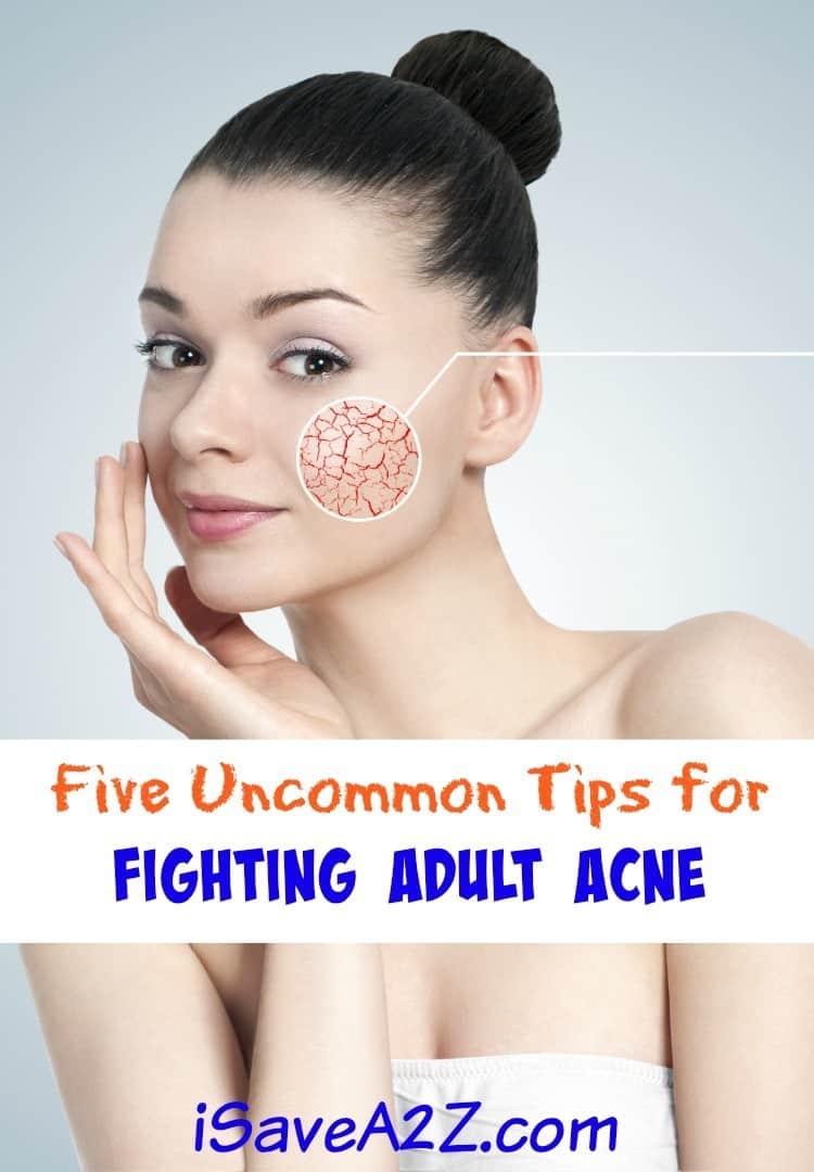Five Uncommon Tips for Fighting Adult Acne