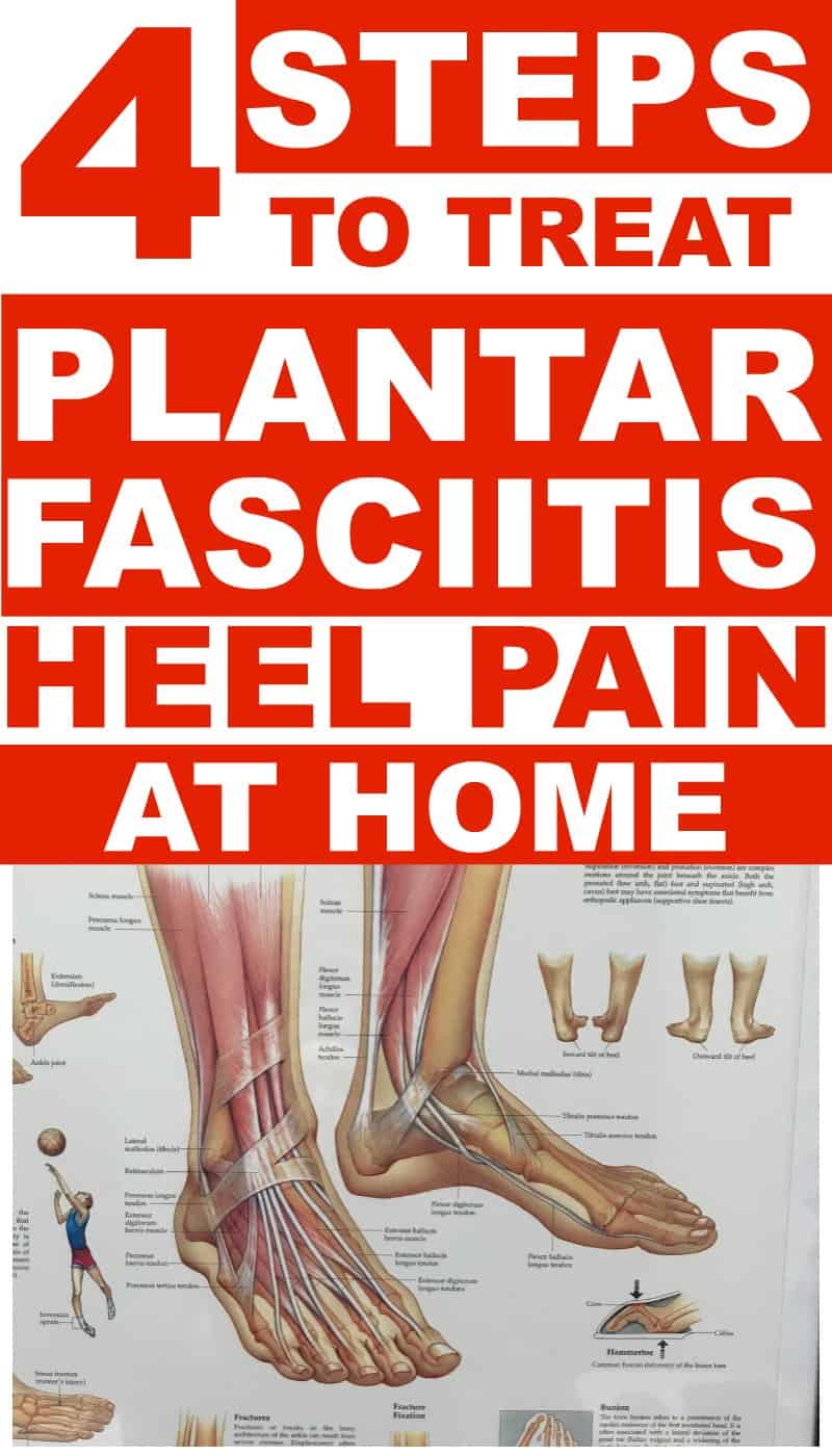 Plantar Fasciitis Treatments You Can Do At Home For Heel Pain!