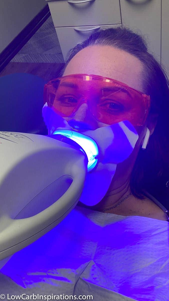 Teeth Whitening Treatment at Walden Dental with Dr. Frank
